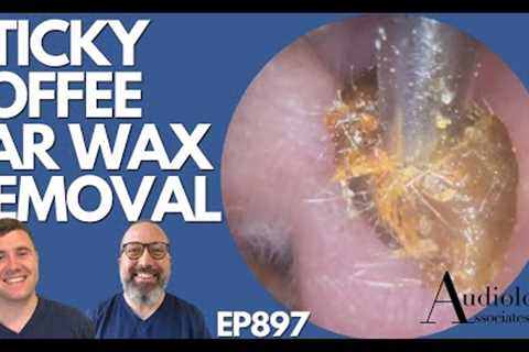 STICKY TOFFEE EAR WAX REMOVAL - EP897